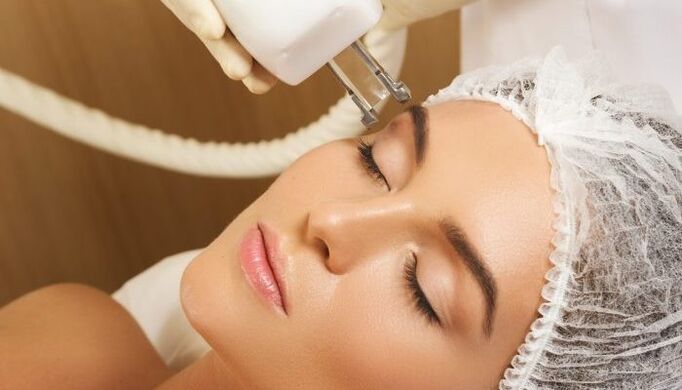 تھرمو لفٹنگ