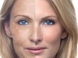 جلد کی رنگت